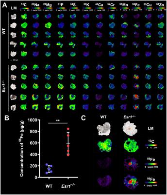 Ovaries of estrogen receptor 1-deficient mice show iron overload and signs of aging